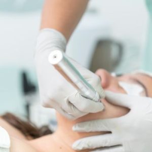 Close-up of a cosmetic treatment being performed in a clinical environment.