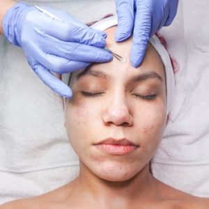 Woman undergoing professional facial treatment with eyes closed and gloves.